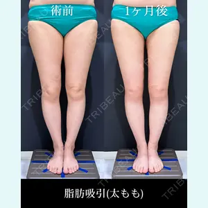 症例