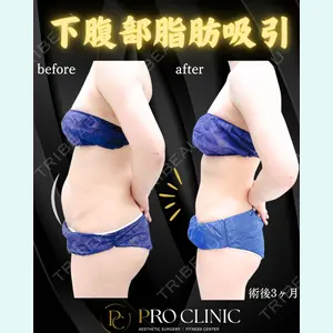 症例