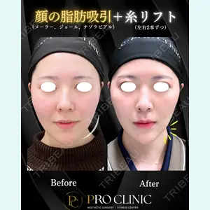 PRO CLINIC プロクリニック 銀座院 洪 嵩典医師の症例
