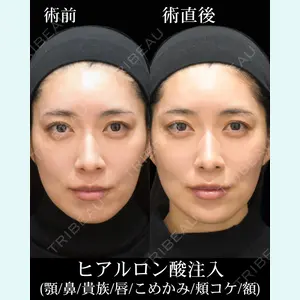 症例