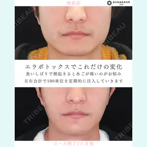 東京形成美容外科 銀座院 中尾 真紀医師の症例