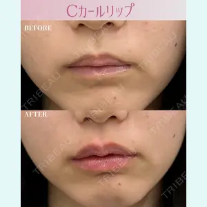 ルラ美容クリニック 東京駅前院 山本 泰輔医師の症例