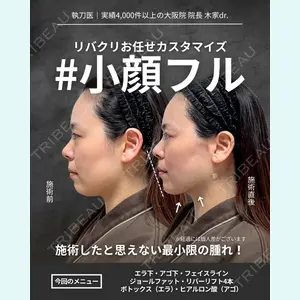 RIVER CLINIC（リバークリニック）大阪院 木家 佑理子医師の症例
