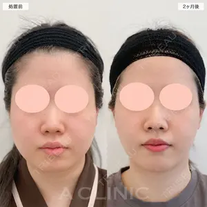症例