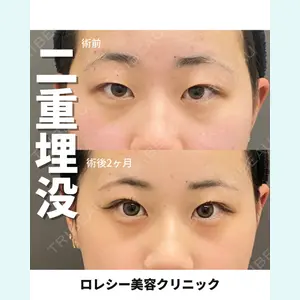 ロレシー美容クリニック 心斎橋駅前院 田中先生医師の症例
