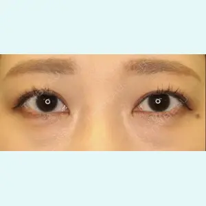 下北沢スキンクリニック 保坂 宗孝医師の症例
