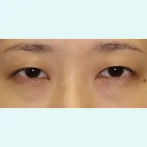 下北沢スキンクリニック 保坂 宗孝医師の症例
