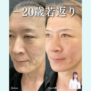 症例