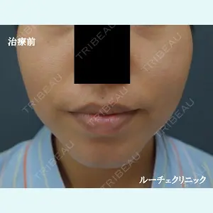 ルーチェクリニック 銀座院 加藤晴之輔医師の症例