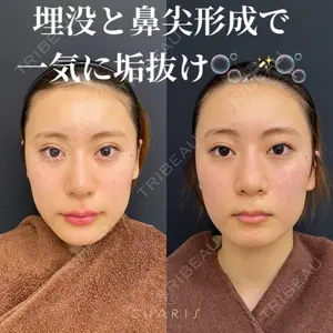 CHARIS BEAUTY CLINICの症例