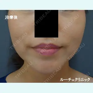 ルーチェクリニック 銀座院 加藤晴之輔医師の症例