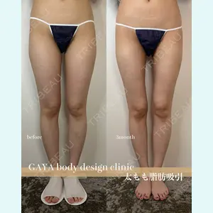 GAYA body design clinic 飯ヶ谷 重来医師の症例