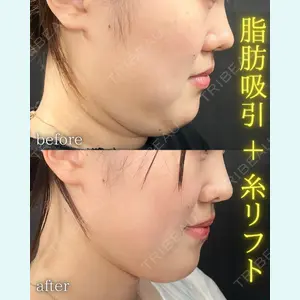 THE FIRST CLINIC 町田院 木暮 啓一郎医師の症例