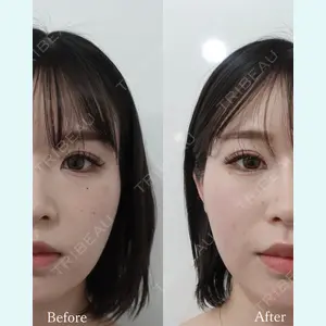 L‘amour clinic Tokyo【ラムールクリニック東京】の症例