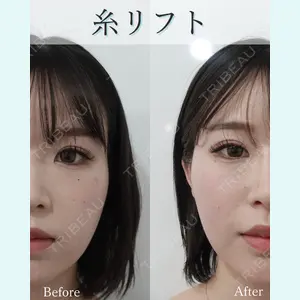 L‘amour clinic Tokyo【ラムールクリニック東京】の症例