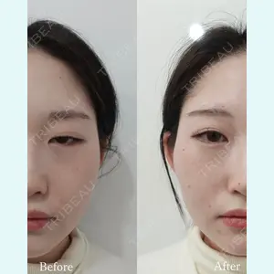 L‘amour clinic Tokyo【ラムールクリニック東京】の症例
