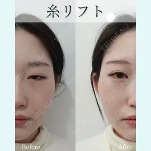 L‘amour clinic Tokyo【ラムールクリニック東京】の症例