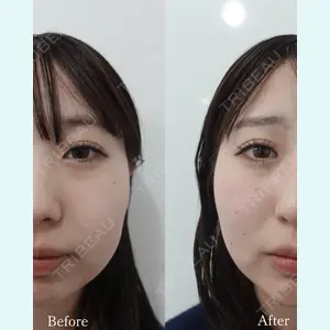 L‘amour clinic Tokyo【ラムールクリニック東京】の症例