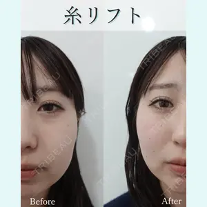 L‘amour clinic Tokyo【ラムールクリニック東京】の症例