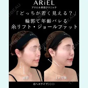 症例