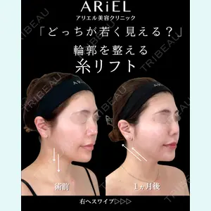 症例