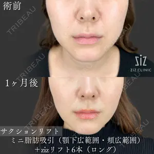 症例