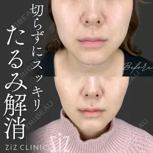 症例