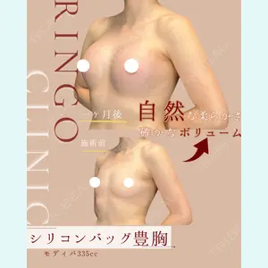 症例