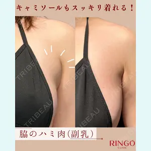 症例