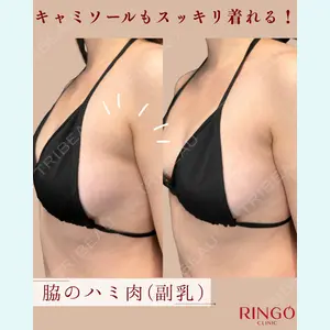 症例