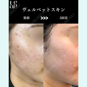 症例
