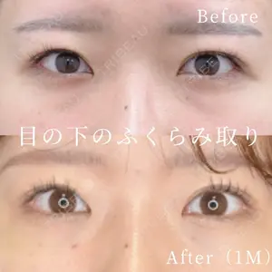 症例
