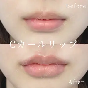 症例