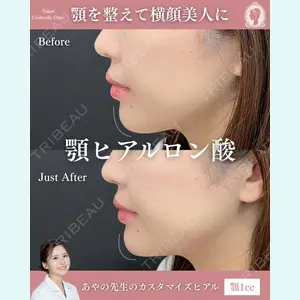 症例