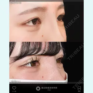 症例