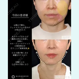 症例