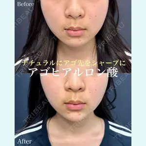 症例