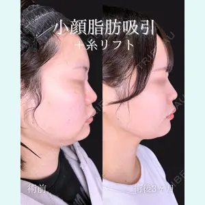 東京シンデレラ美容外科 池袋院 石井 達也医師の症例