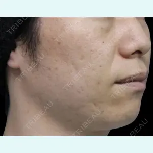 下北沢スキンクリニック 保坂 宗孝医師の症例