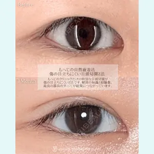 博多もへじのクリニック 村田 将光医師の症例