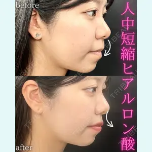 症例