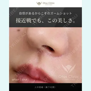症例
