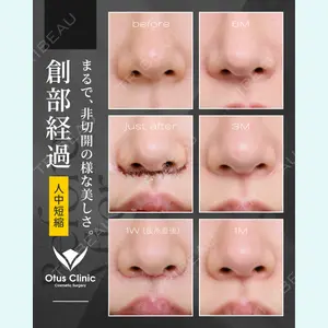 症例