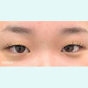 神戸スイミー皮膚科美容外科の症例