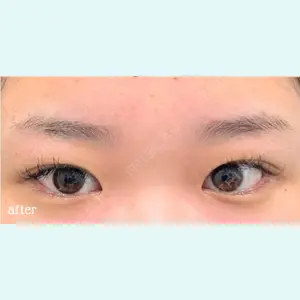 神戸スイミー皮膚科美容外科の症例
