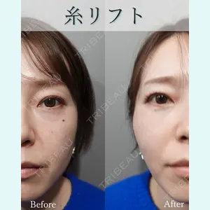 L‘amour clinic Tokyo【ラムールクリニック東京】の症例
