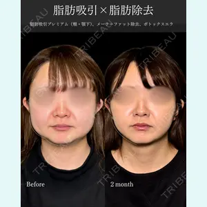 PRISM Beauty Clinicの症例