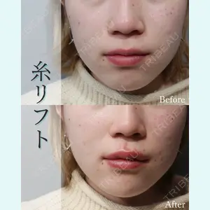 L‘amour clinic Tokyo【ラムールクリニック東京】の症例
