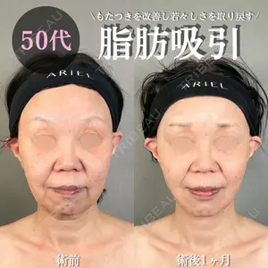 症例