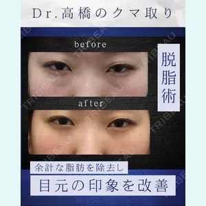 症例